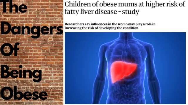 Obesity Harms Children IN THE WOMB