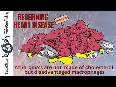 Is Cholesterol Really to Blame? Unmasking the True Culprit of Heart Disease